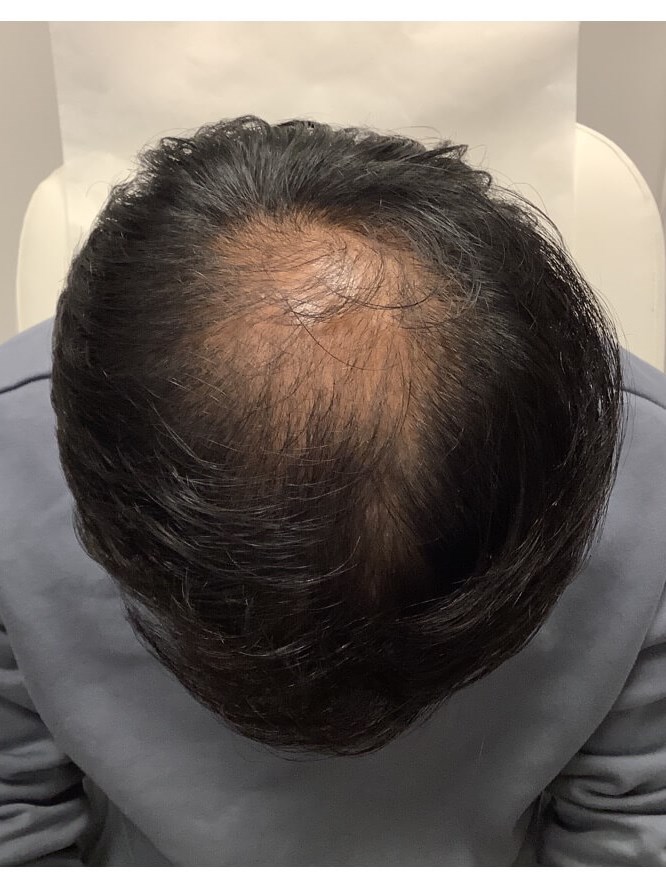 Before Image