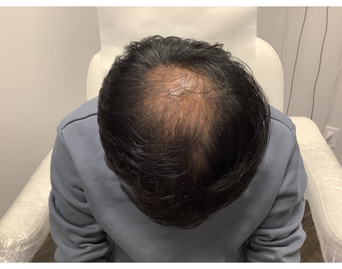 Before Image