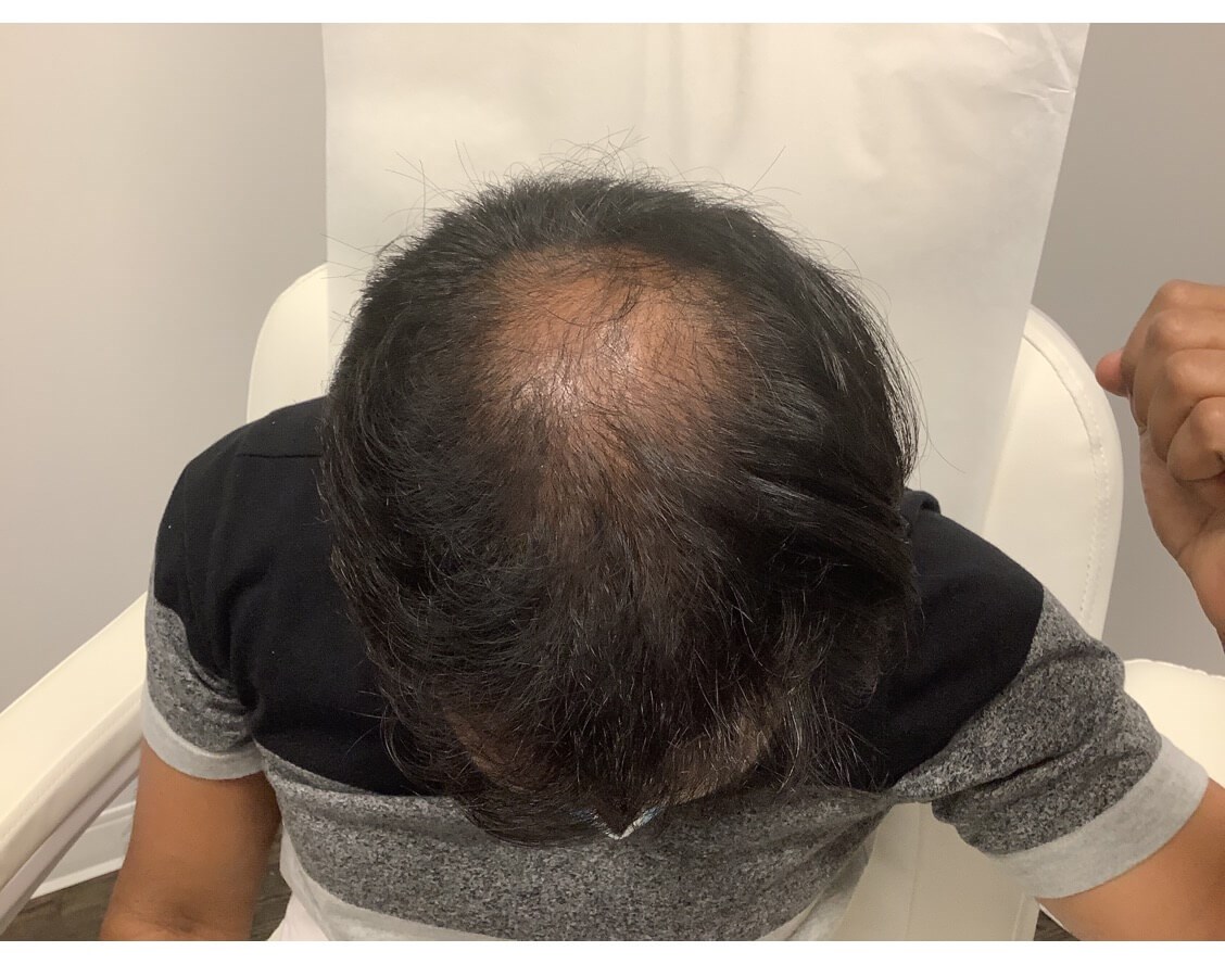 After Image