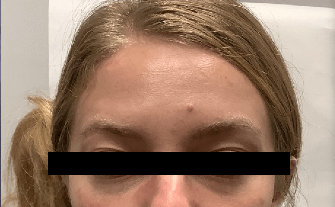 Before Image