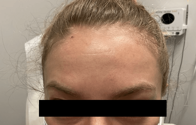 After Image